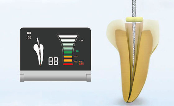 อลูมิเนียมอัลลอยด์ Apex Locator Endo Motor 50-60Hz สำหรับการรักษาคลองรากฟัน