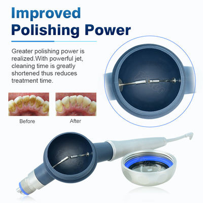 SS Dental Air Prophy Mate การทำความสะอาดฟันฟอกสีฟัน Airpolishing Therapy ระบบขัดฟัน