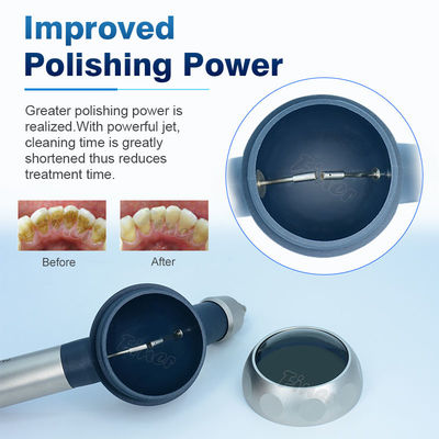 ระบบเคลือบฟันด้วยพลังงานอากาศ Air Prophy Jet Air Flow Prophy Mate